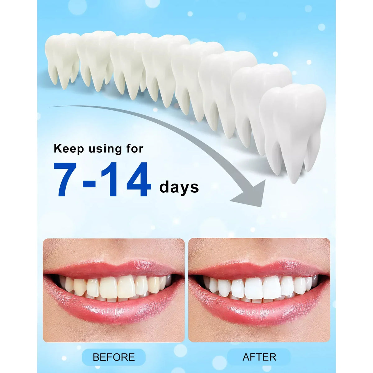 2Packs Deluxe Teeth Whitening Kit with 28-LED Light, 8X Teeth Whitening Pen Whitening Gel Refills, 10Mins Results, Remove 10 Years of Stains
