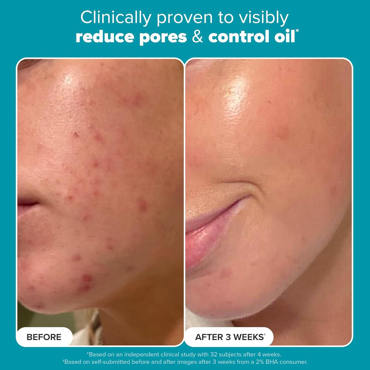SKIN PERFECTING 2% BHA Liquid Exfoliant Polish, Salicylic Acid Exfoliant-Facial Polish for Enlarged Pores, Wrinkles & Fine Lines, Suitable for Blackhead-Prone Skin, Fragrance-Free