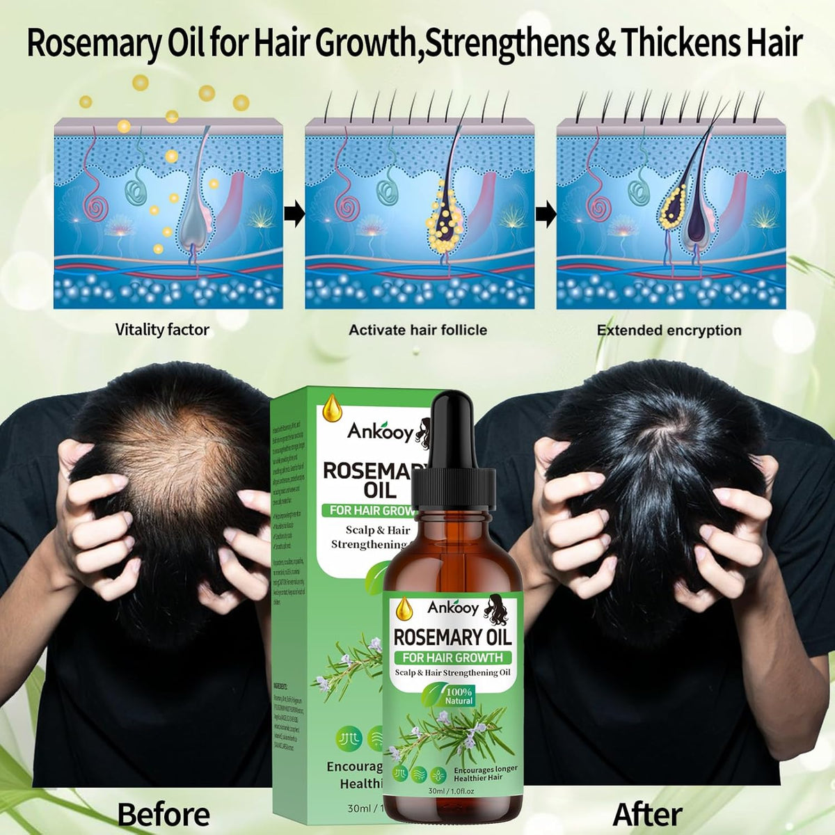 3 Pack Rosemary Oil for Hair Growth,Rosemary Hair Growth Oil,Hair Strengthening Serum for Dry Damaged Hair,Hair Loss Treatment & Thickens Hair,Scalp Care Promotes Hair Thickness for Men Women