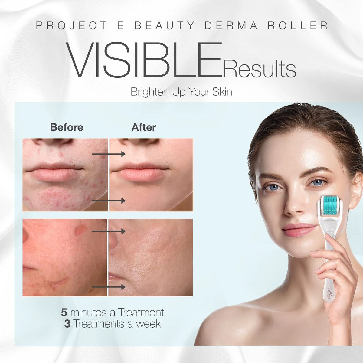 the Derma Roller | 540 Titanium Microneedle Facial Tool | for Smoother Skin